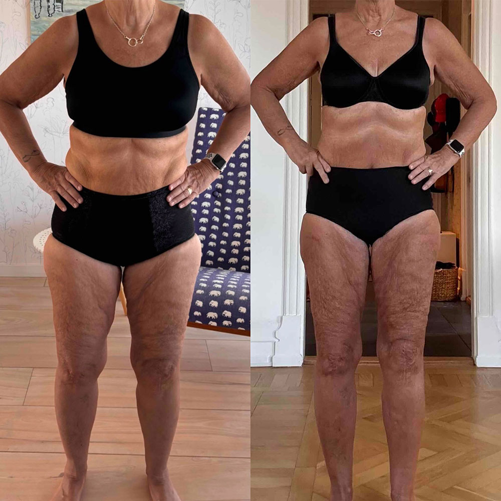 Transformation 3